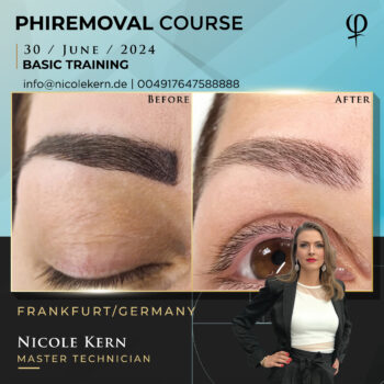 PhiRemoval Frankfurt 30.06.2024 live Schulung für ONLINE Studenten